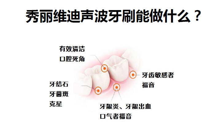 秀麗維迪聲波牙刷（感應式/干電池）成人聲波牙刷、兒童聲波牙刷
